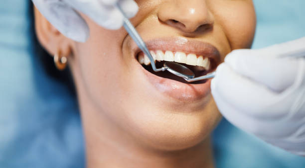 Best Emergency Dental Care for Broken or Chipped Teeth in Ross, OH